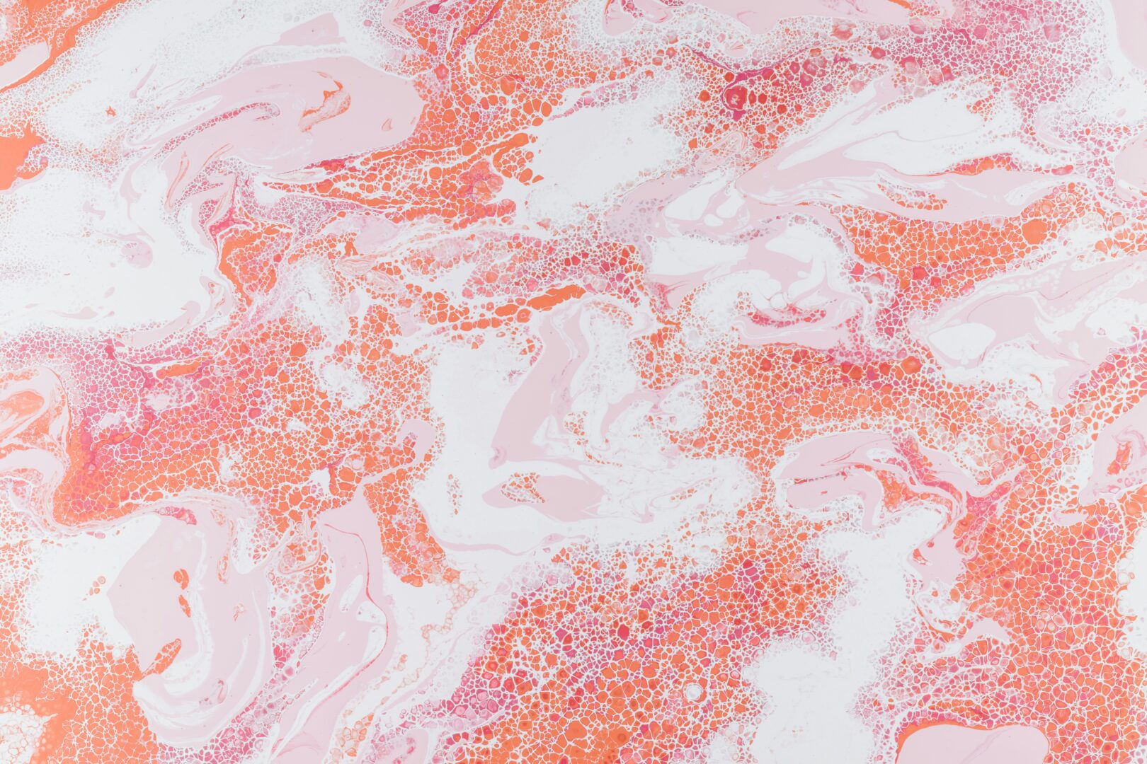 cystic-fibrosis