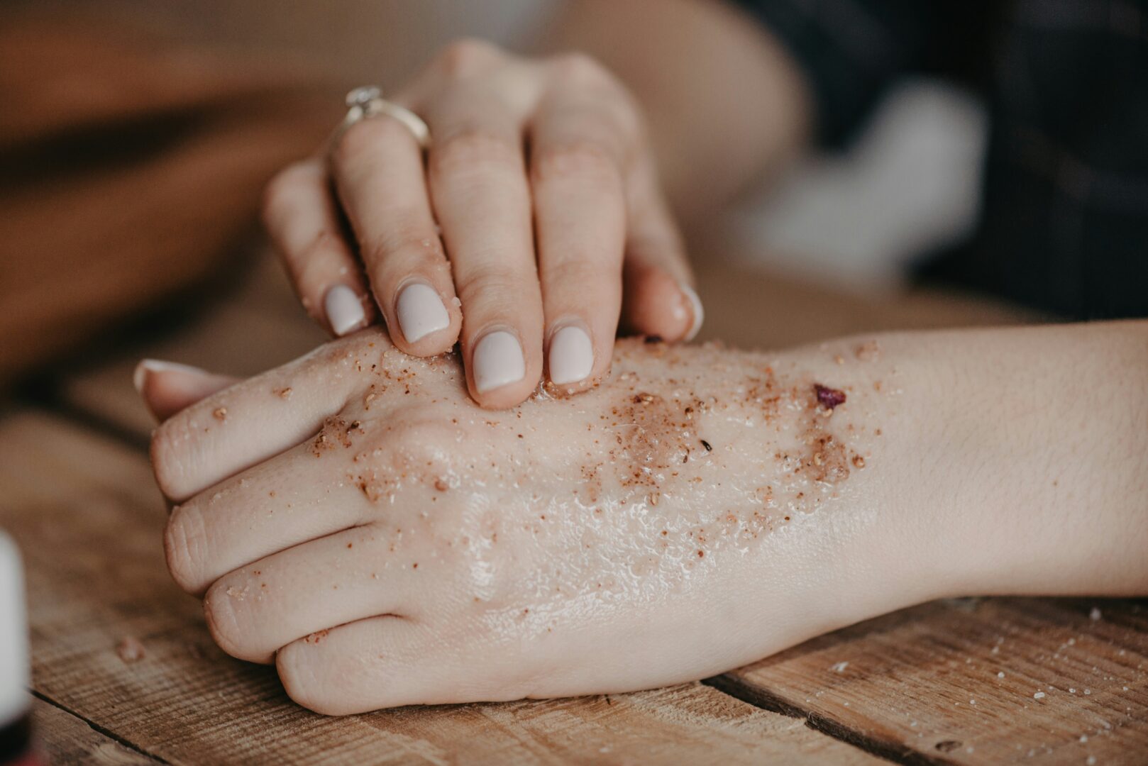 Eczema